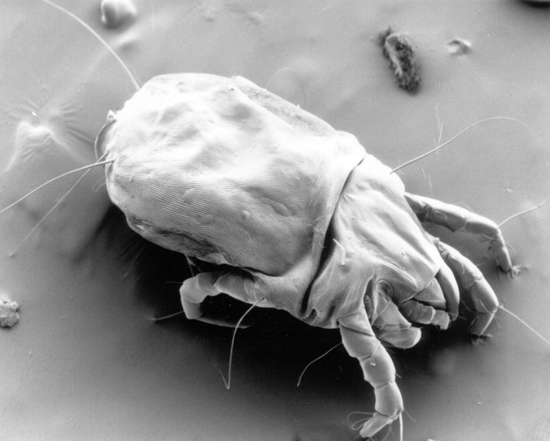 The allergen nobody talks about